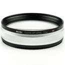 Buy NiSi 77mm Close-Up NC Lens Kit II with 67 and 72mm Step-Up Rings
